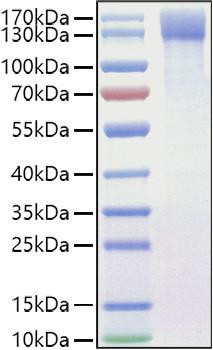 Recombinant Mouse OSMR/IL-31RB Protein (RPCB1042)