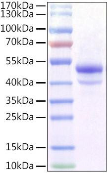 Recombinant Mouse Carbonic Anhydrase IX/CA9 Protein (RPCB1093)
