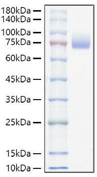 Recombinant Mouse ALCAM/CD166 Protein (RPCB1090)