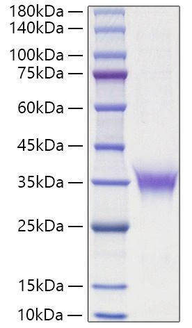 Recombinant Rat Erythropoietin/EPO Protein (RPCB1115)