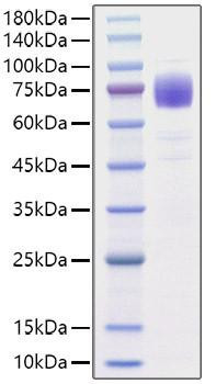 Recombinant Human IL-10RA/CD210 Protein (RPCB1147)