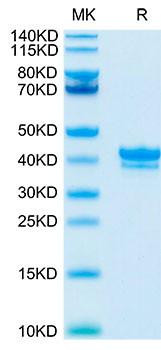 Recombinant Cynomolgus TNFRSF17/BCMA/CD269 Protein (RPCB1174)