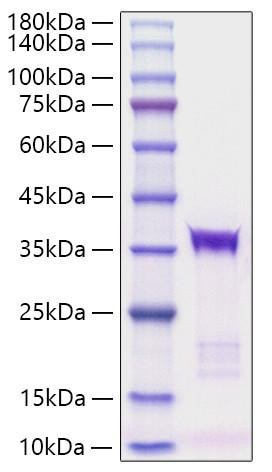 Recombinant human IGFBP-5 Protein (RPCB1204)
