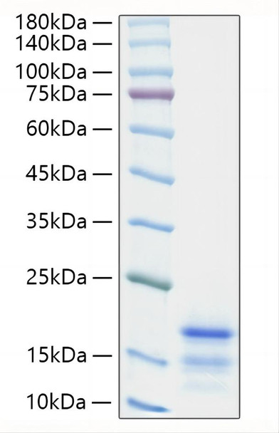 Recombinant Mouse CCL21/6Ckine Protein (RPCB1234)