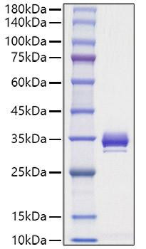 Recombinant Mouse Angiopoietin-1/ANG-1/ANGPT1(277-498) Protein (RPCB1242)