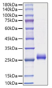 Recombinant Human Interferon omega-1/IFNW1 Protein (RPCB1248)