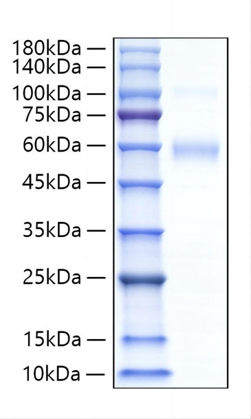 Recombinant Human Siglec-5/CD170 Protein (RPCB1299)