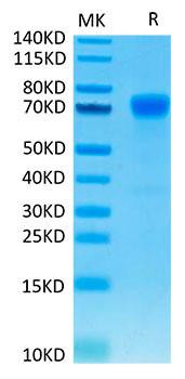 Recombinant Human B7-H1/PD-L1/CD274 Protein (RPCB1348)