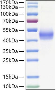 Recombinant Human TGFR-1/ALK-5 Protein (RPCB1424)