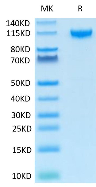 Recombinant Human IL-27RA/TCCR Protein (RPCB1450)