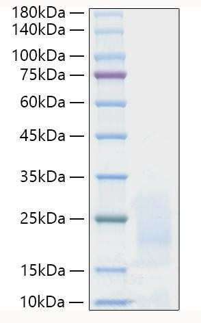 Recombinant Human Prostate stem cell antigen/PSCA Protein (RPCB1465)