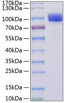Recombinant Mouse VCAM-1/CD106 Protein (RPCB1506)