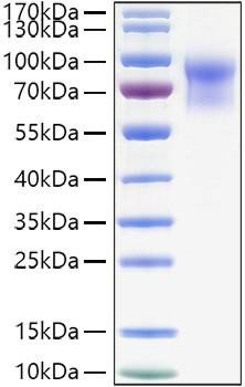 Recombinant Mouse IL-15RA/CD215 Protein (RPCB1545)