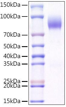 Recombinant Mouse CD200R1 Protein (RPCB1570)
