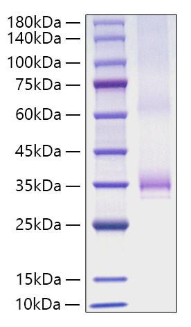 Recombinant Human Angiopoietin-1/ANG-1/ANGPT1(277-498) Protein (RPCB1619)