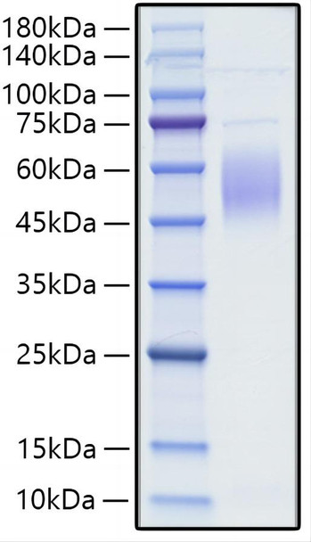 Recombinant Human CRTAM/CD355 (A65V) Protein (RPCB1664)