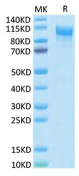 Recombinant Human IL-31RA Protein (RPCB1747)