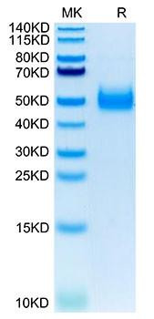 Recombinant Human IL-17RB Protein (RPCB1757)
