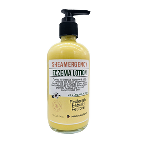 Eczema Lotion