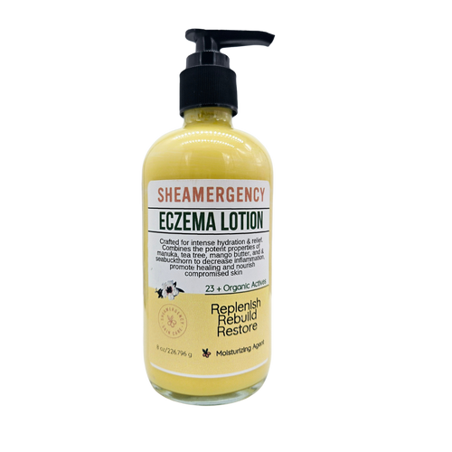 Eczema Lotion