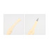 A pen designed to resemble a knee joint, featuring a creamy colour and a silver pen tip.