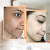 BELO Intensive Whitening Bar Kojic Acid Plus Tranexamic Acid Soap 65g x 3 BELO Intensive Whitening Bar Kojic Acid Plus Tranexamic Acid Soap 65g x 3