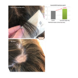 NEW! Meso Hair Loss Control - Eigh Actions to Redensity