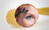 The Advantages of Using Derma Roller to Get Rid of Scars - Which Size is Right for Me?