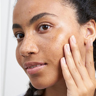 The Different Types of Hyperpigmentation