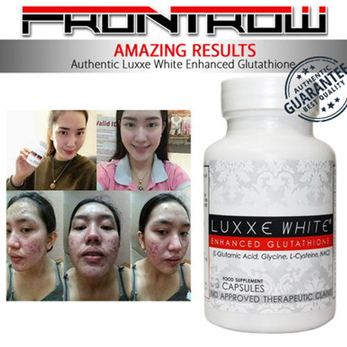 NEW Authentic Luxxe White Enhanced Glutathione & Luxxe Protect Pure Grapeseed Extract & 01 Skin Whitening Soap Bar - SET 