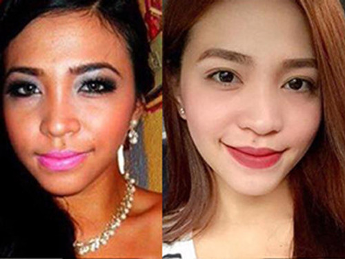 RELUMINS GLUTATHIONE VIALS - ADVANCED FORMULA 7500MG - Complete Skin Lightening Set