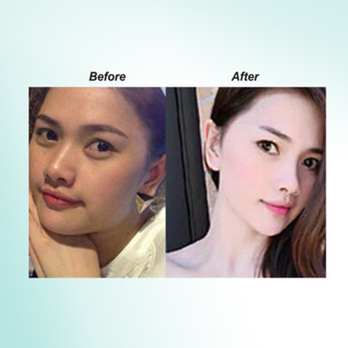 Authentic Relumins Advanced White Oral Glutathione with Vit C & ALA - Skin Repair Capsules - Lightens, repairs & rejuvenates skin - Now with Plant Placenta - Kosher, Vegan & Hallal