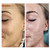 NEW! Meso Fresh Vitamin - Rebuilding the Skin!