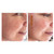 NEW! Meso Fresh Vitamin - Rebuilding the Skin!