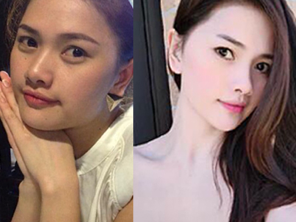 Relumins Advanced White Oral Whitening Formula Capsules