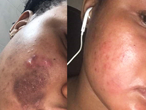 Relumins Advanced Glutathione 2000mg