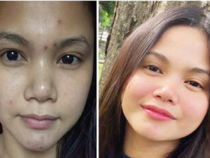 Dalfour Beauty Gold Seal EXCEL Whitening Cream-Maximum Strength