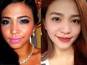 Relumins Glutathione Vials - New Advanced Formula 15000mg