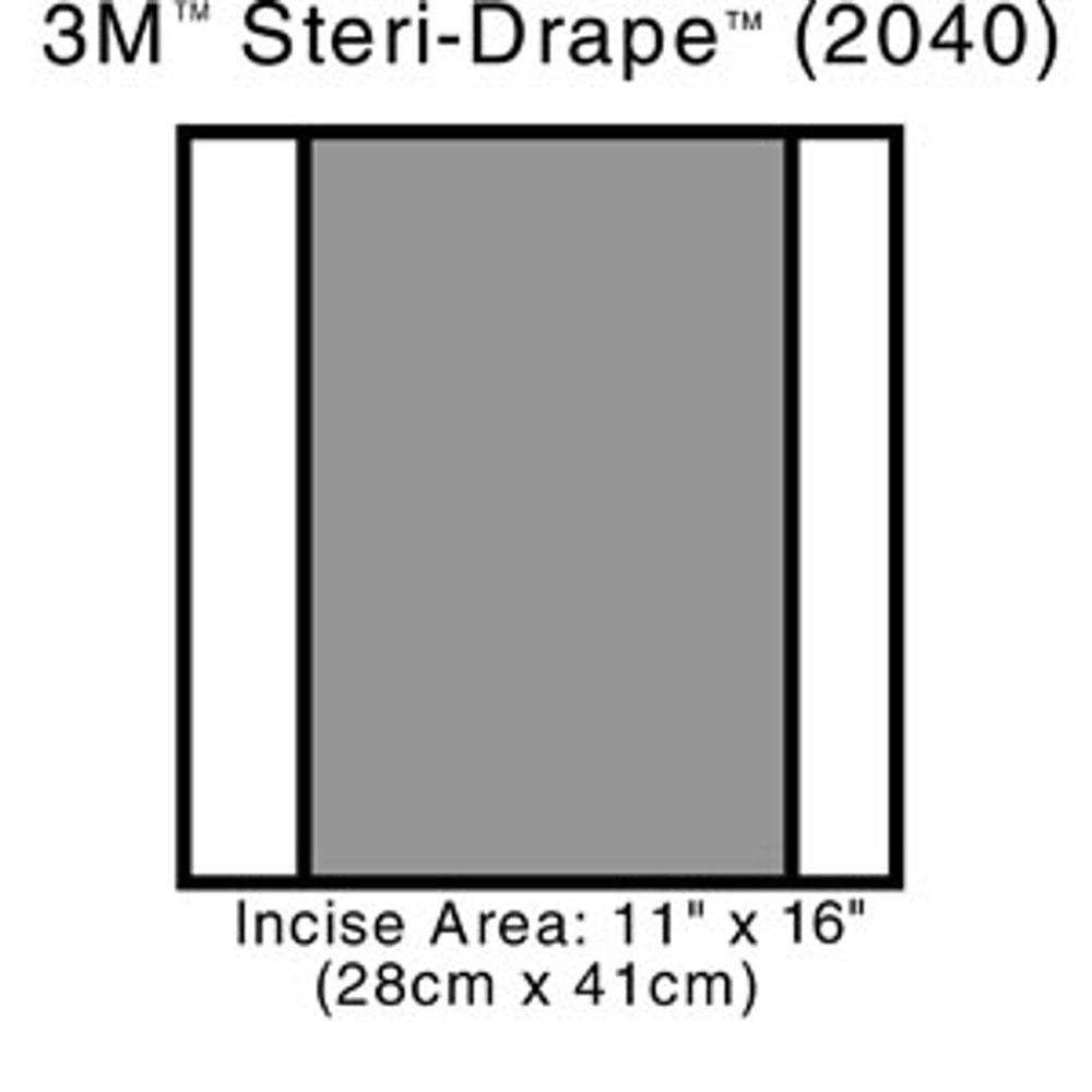 Solventum Corporation  2040 Incise Drape, Overall 14" x 16", Incise 11" x 16", 10/bx, 4 bx/cs (Continental US+HI Only)