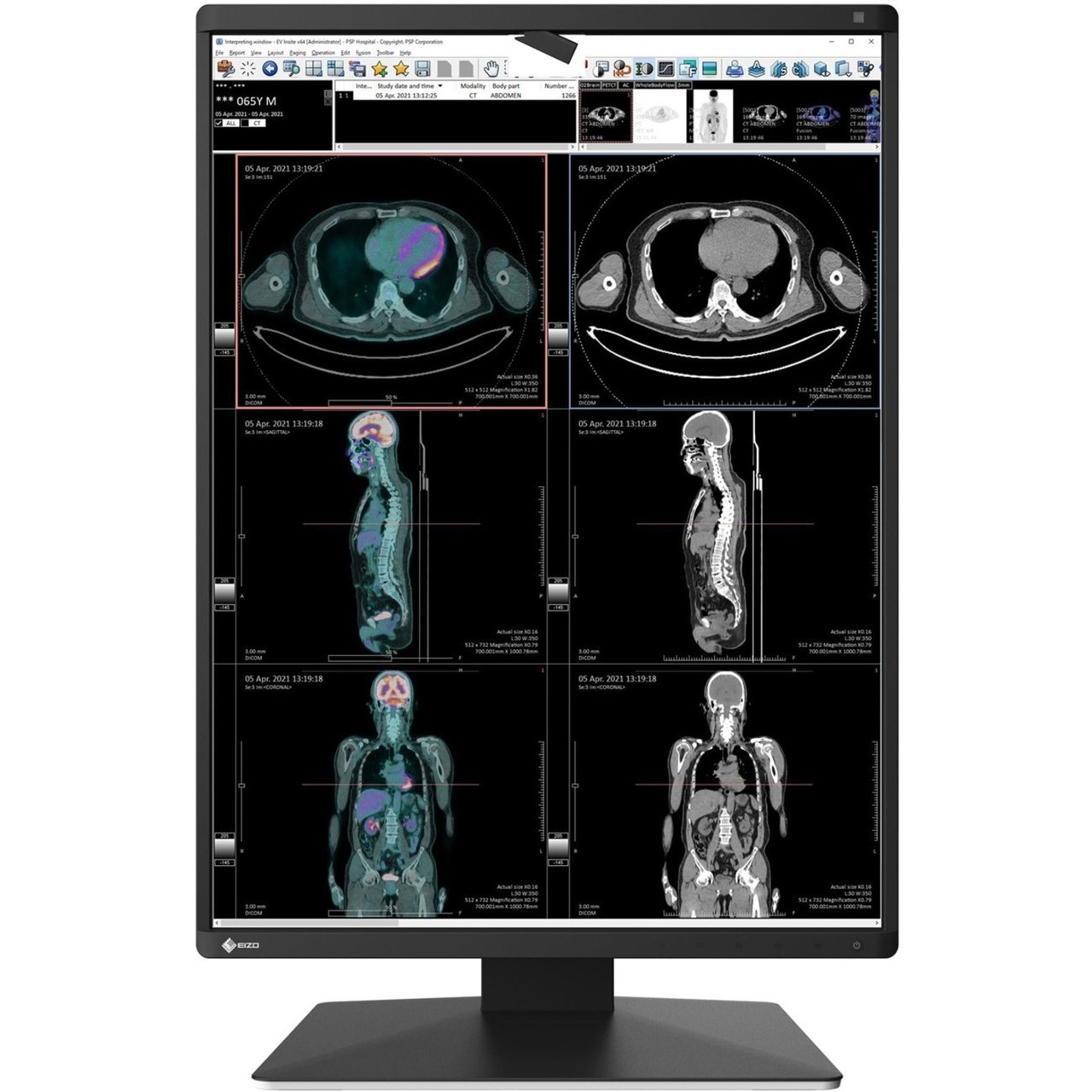 EIZO RadiForce RX370-BK 21.3" QXGA LED LCD Monitor - 3:4 - Black - RX370-BK