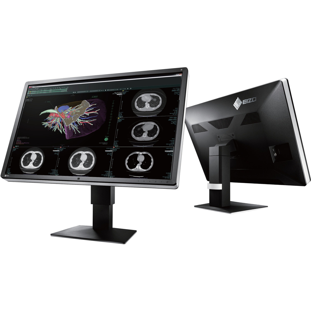 EIZO RadiForce RX660-BK 29.9" WQSXGA LED LCD Monitor - 16:10 - Black, White - 30" Class - 3280 x 2048 - 1.07 Billion Colors - 1000 Nit - 25 ms - DVI - VGA - DisplayPort - USB Hub - RX660-BK