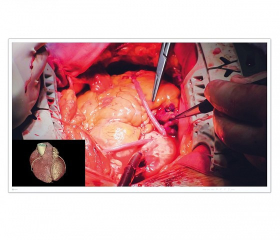 Eizo Curator EX4942 A 49-Inch Widescreen Surgical Monitor With 4K UHD (3840 X 2160 Pixels) Resolution -EX4942