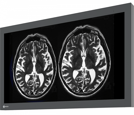 EIZO CuratOR 32-inch monitor with 4K UHD resolution for Magnetic Resonance Imaging (MRI) -LX3240-MR
