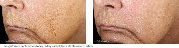 Zo Skin Health Wrinkle + Texture Repair 1 oz - 30 ml