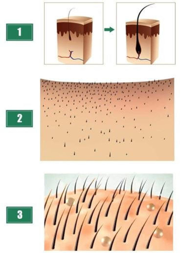 Serum Naturel contre la perte de Cheveux zaxx