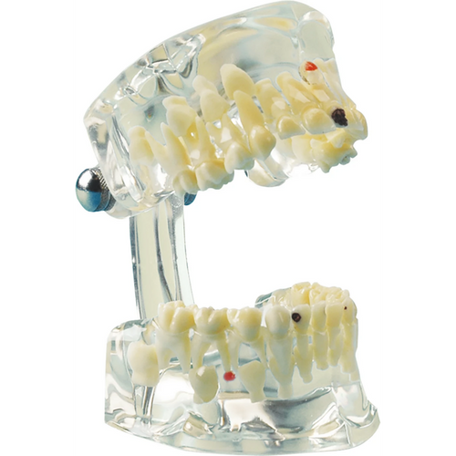 Gjennomsiktig studiemodell barn stk. under- og overkjeve med ti melketenner, gjennomsiktig