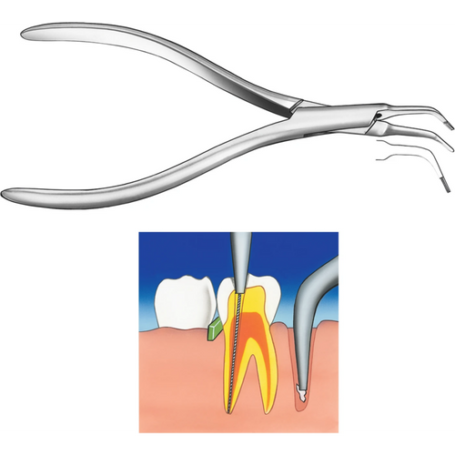 Nervekanaltang stk. 1206, meget fin