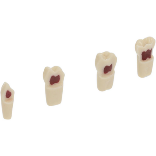 Modelltann barn AK-6/2 stk. fylt med voks, nr. 55, UK