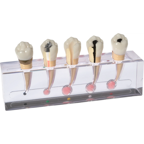 Endo modell "Granuloma" P23-END.2 stk.