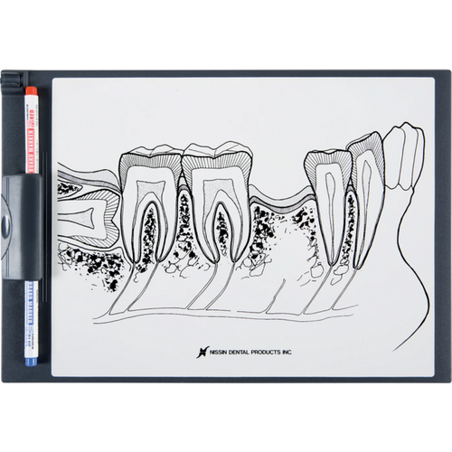 Demonstrasjonsbord posterior region P13-TR200 stk.